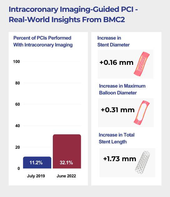 In July 2019, 11.2% of PCIs were performed with intracoronary imaging. That number increased to 32.1% by June of 2022. There was a +0.16 mm increase in stent diameter, a +0.31 mm increase in maximum balloon diameter, and a +1.73% mm increase in total stent length.